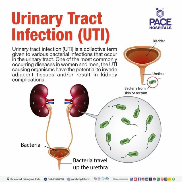 Urinary tract infection Symptoms Causes Prevention Treatment